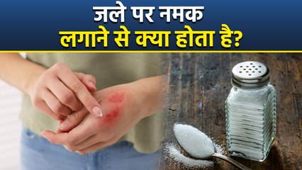 Salt On Burn: जले पर नमक लगाने से क्या होता है,तुरंत क्या करें | क्या नहीं करना चाहिए | Boldsky