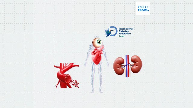 В каких странах Европы наиболее распространен диабет?