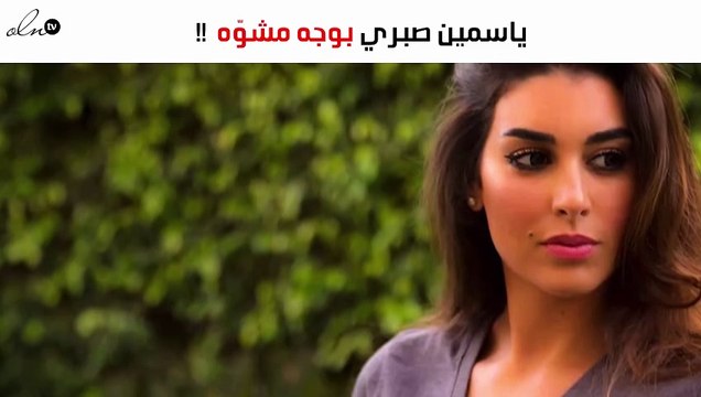 الجمهور في حيرة بسبب صورة مُرعبة لياسمين صبري