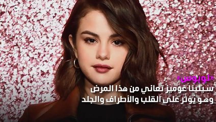 مشاهير يعانون مع أمراض غريبة لم تسمعي بها من قبل!