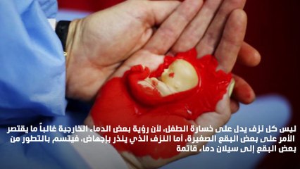 4 مؤشرات تدل على احتمال الإجهاض... كيف تتفادينه