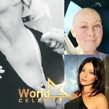 هل تذكرون هذه النجمة...شاهدي هذا الفيديو لتعرفي كيف أصبح شكلها بعد الكيماوي ..ولماذا انتشر !!