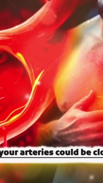 Your arteries could be clogged right now without you knowing it!In this video,#HeartHealth #HealthyEating #UnclogArteries #CardiovascularHealth #NutritionTips #HealthyLifestyle #Garlic #Avocado #Omega3 #Shorts #Reels #ViralVide