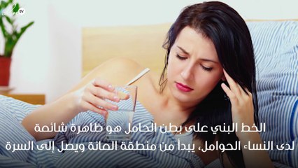 كل ما يجب أن تعرفينه عن الخط البني على بطن الحامل