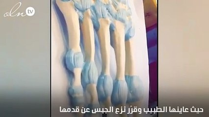 لأصحاب القلوب القوية... أحلام  في المستشفى تنزع الـ"جبس" عن قدمها