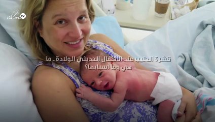 قشرة الحليب عند الأطفال الحديثي الولادة.. ما هي وما أسبابها؟