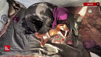 Gazze’de 10 yaşındaki Nafız açlıktan 8 kiloya düştü