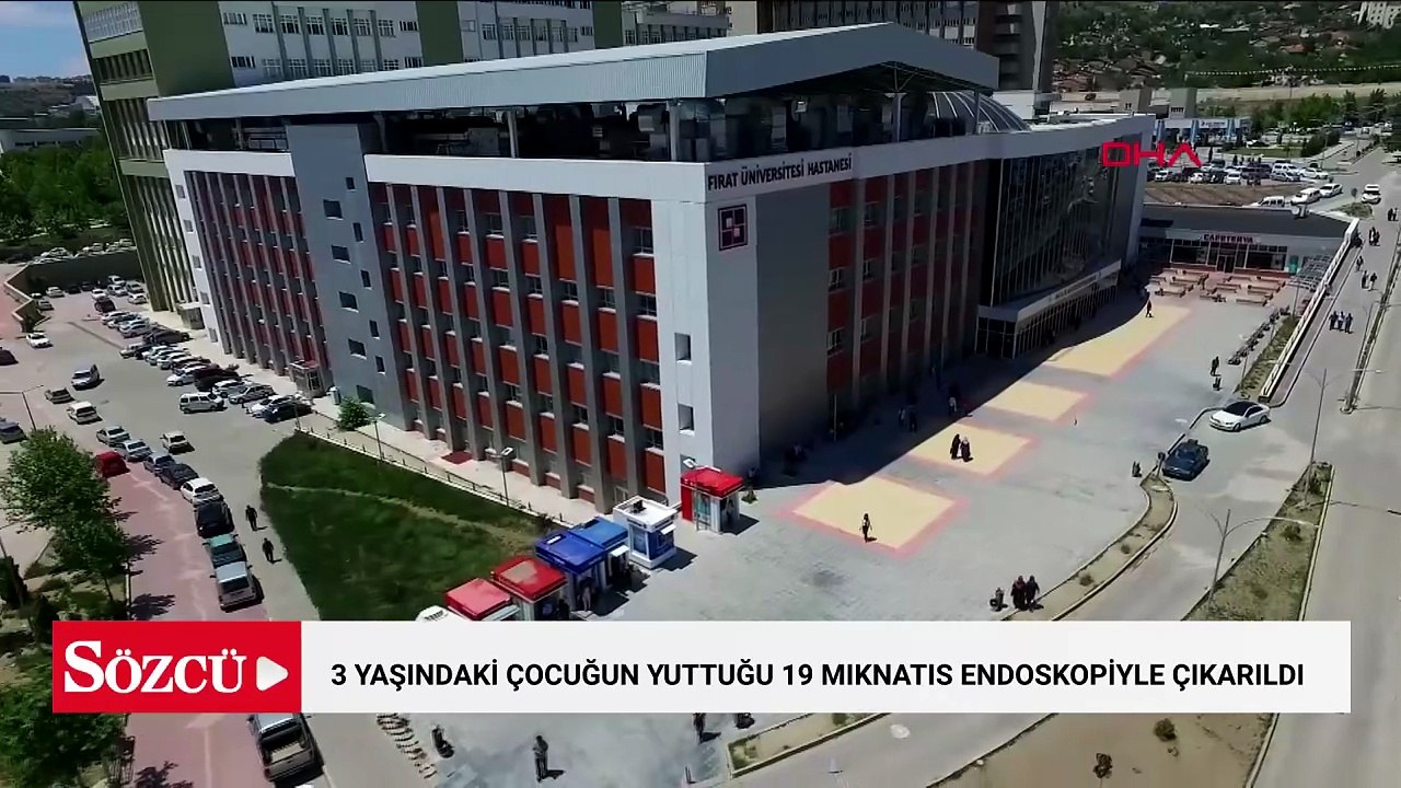 3 yaşındaki çocuğun yuttuğu 19 mıknatıs endoskopiyle çıkarıldı