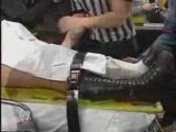 Ashley Massaro breaks her ankle