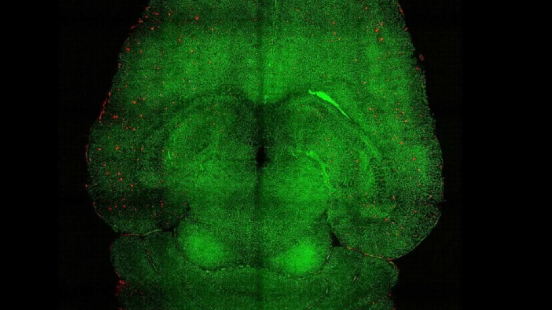 Consiguen revertir el Alzheimer el equivalente a 20 años humanos usando nanopartículas