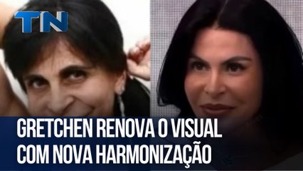 Gretchen renova o visual com nova harmonização
