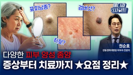 [메디컬 인사이트 105회] 피부과 전문의가 알려주는 '피부양성종양의 치료법' / YTN