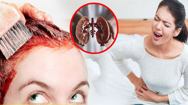Hair Dye Side Effects: 20 Year Old Girl का Hair Color से Kidney Damage, क्यों खतरनाक है |Cancer Risk