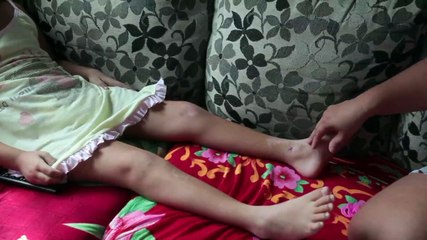 Dia Internacional da Menina: A Luta de Kemely Ketley Após Acidente com Metrô em Recife