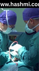 Tamatar Khane Ke Fayde (2)