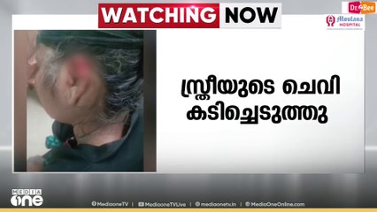 തൃശൂർ ഗുരുവായൂരിൽ സ്ത്രീയുടെ ചെവി കടിച്ചെടുത്ത് തെരുവുനായ