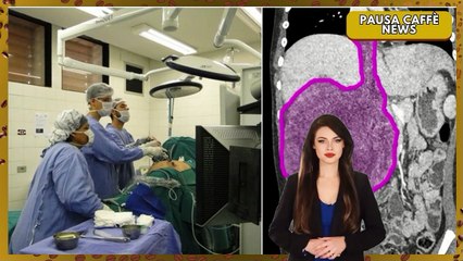 Ultrasuoni contro il tumore, la scoperta dell’istotripsia spiegata passo dopo passo