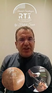 11 SAÇ SİMÜLASYONU PİGMENT BİTKİ BOYASI NEDİR? (SAÇ SİMÜLASYONU AKADEMİSİ) BY HALUK ŞENER