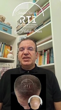 12 SAÇ SİMÜLASYONU PİGMENT BOYASI HAKKINDA BİLGİ (SAÇ SİMÜLASYONU AKADEMİSİ) BY HALUK ŞENER