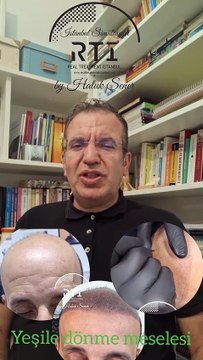 13 SAÇ SİMÜLASYONU PİGMENT RENGİNİN YEŞİL VE MAVİYE DÖNMESİNİN SEBEBİ NEDİR? BY HALUK ŞENER