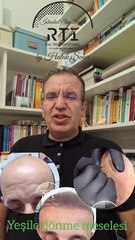 13 SAÇ SİMÜLASYONU PİGMENT RENGİNİN YEŞİL VE MAVİYE DÖNMESİNİN SEBEBİ NEDİR? BY HALUK ŞENER