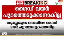 സുമയ്യയുടെ നെഞ്ചിൽ കുടുങ്ങിയ ഗൈഡ് വയർ കീഹോൾ വഴി പുറത്തെടുക്കാനുള്ള ശ്രമം പരാജയപ്പെട്ടു