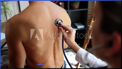 Medical warning as Tuberculosis is on the rise