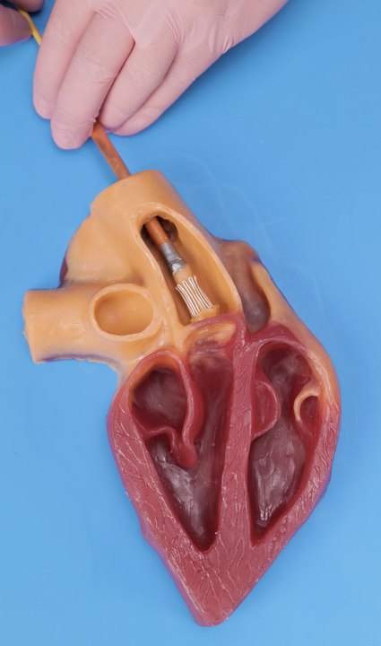 What’s behind body surgery? Medical procedures explained in a simple way!