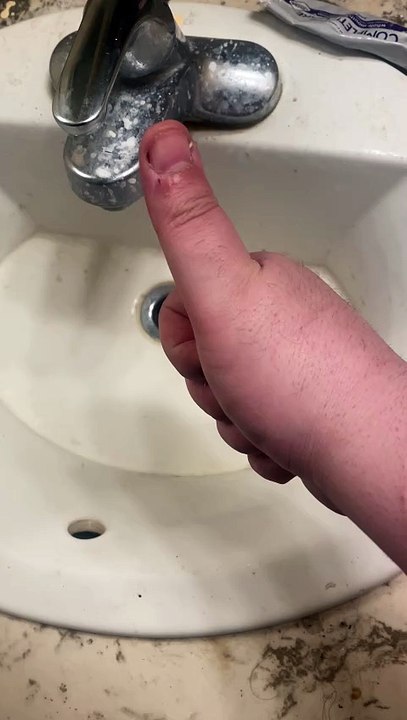 How To Remove a Can