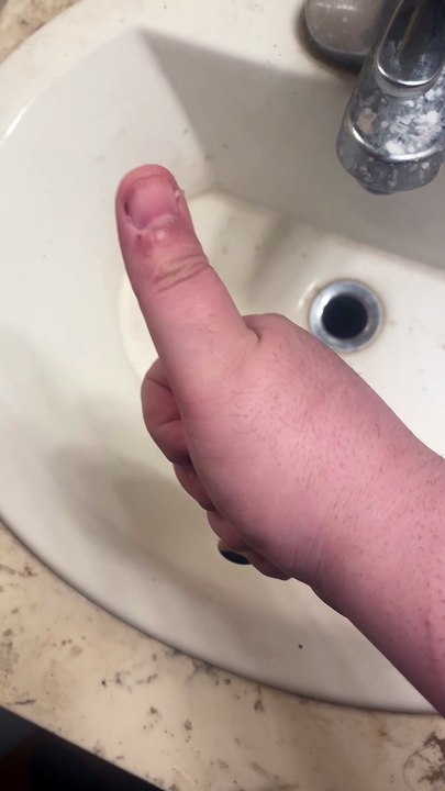 How to remove a can