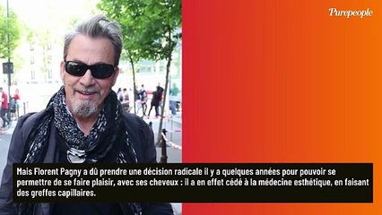"Ca a super bien marché !" : Florent Pagny a lui aussi cédé à la médecine esthétique