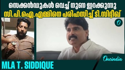 'മൂക്കിനകത്ത് ശസ്ത്രക്രിയ നടത്താൻ താടിയും മീശയും വടിക്കണം എന്നാണ് പുതിയ പ്രചാരണം'|T Siddique