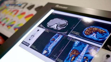 Dấu hiệu của của bệnh lý ung thư vú thường gặp nhất