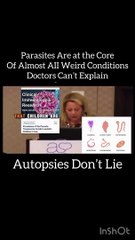 Parasites are at the core of almost all conditions doctors can't explain