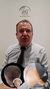 18 SAÇ SİMÜLASYONU KİMLERE YAPILIR? SAÇ SİMÜLASYONU AKADEMİSİ BY HALUK ŞENER