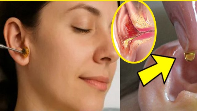 Kaan Se Pani Nikalne Ka Karan: कान से पानी निकलें तो क्या करें | Kaan Se Pani Nikle To Kya Kare ?