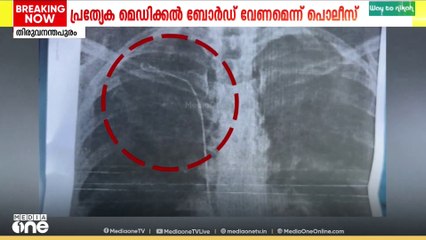 നെഞ്ചിൽ ഗെെഡ് വയർ കുടുങ്ങിയ സംഭവം; പ്രത്യേക മെഡിക്കൽ ബോർഡ് വേണമെന്ന് പൊലീസ്