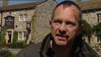 Emmerdale Jack Sugden Snr Beats up Billy Hopwood 15th October 2007