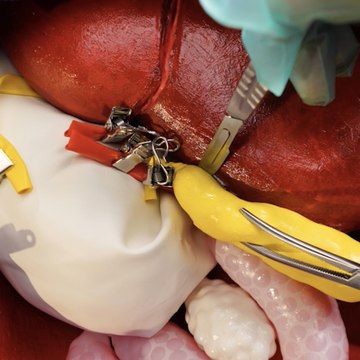 Jouer au docteur : Défi de compétences en chirurgie