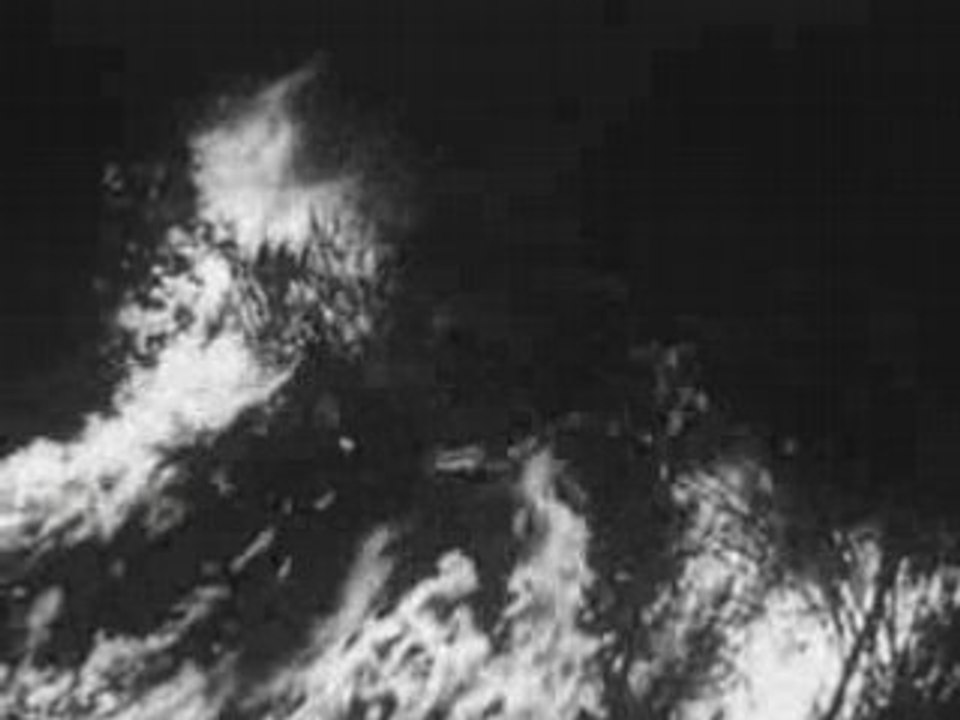 Fire Safety & Fire Burn Injuries Prevention Film (1950s)