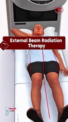 External Beam Radiation Therapy #radiation #therapy