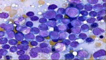 BREAST CANCER AWARENESS MONTH