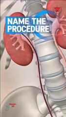 What is the name of this procedure?