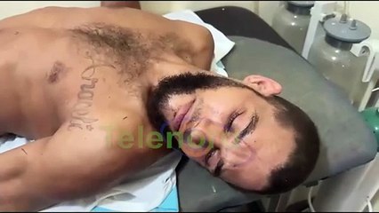 Hieren joven a tiros en el sector Las Colinas de SFM