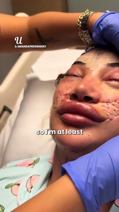 Viral