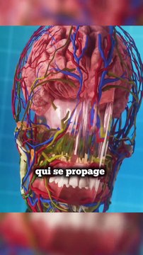 Se claquer les oreilles