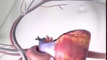 Name the procedure...