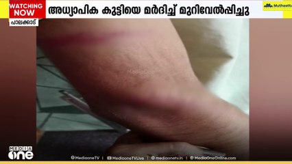 'എന്റെ മോനെ ആ ടീച്ചർ മൃ​ഗങ്ങളെ അടിക്കുന്നതു പോലെയാണ് അടിച്ചത്, നഷ്ടപ്പെട്ടത് ഞങ്ങൾ മാത്രം'