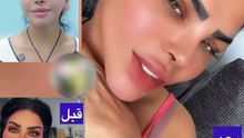 تغيير جذري في شكل مها محمد بعد التجميل