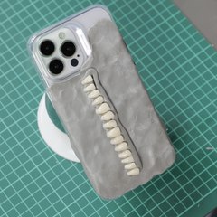 You'll never guess what the end result looks like! 🦷😲 #phonecase
